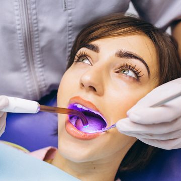The Added Benefits of Professional Teeth Cleaning