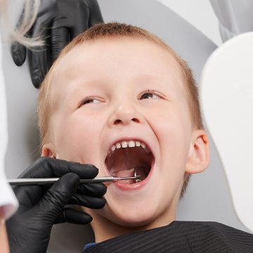 What are Dental Sealants, and Does any Child Need Them?
