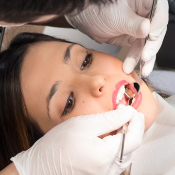 Know All about Root Canal Treatment: Procedure, Concerns, and FAQs