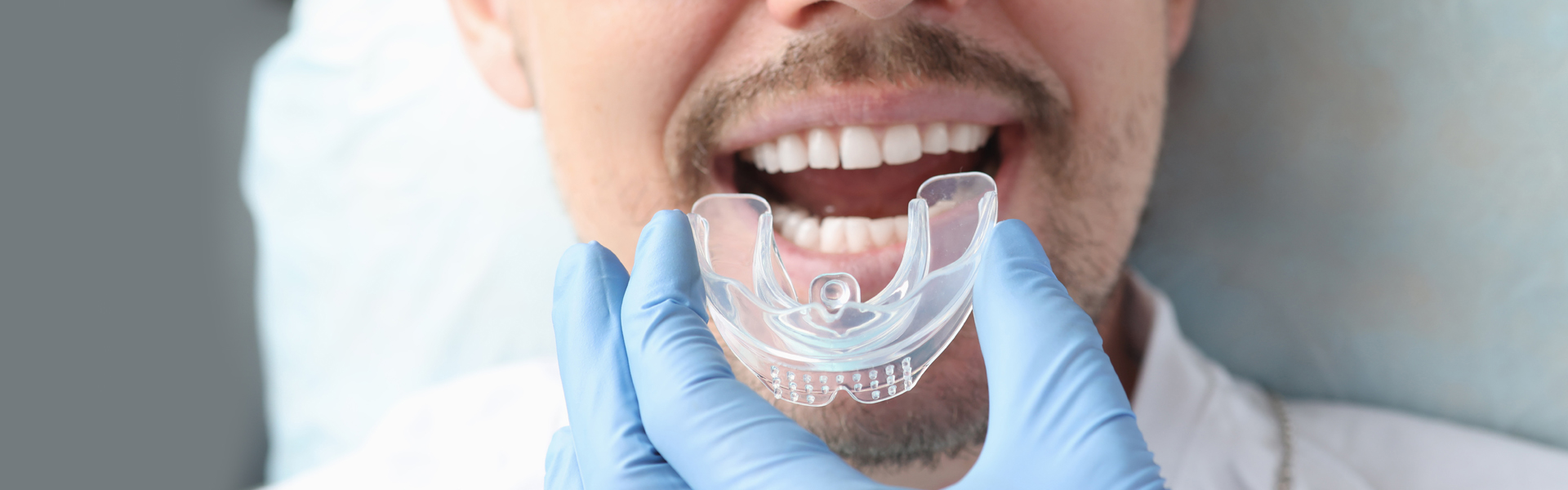 5 Benefits of Wearing Mouth Guards for Contact Sports