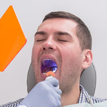 8 Tips for a Smooth Recovery After Tooth Extraction Surgery
