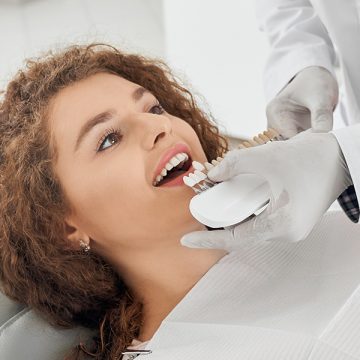 What Are the Benefits of Having Dental Veneers in Fanwood?