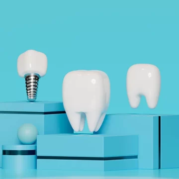 9 Things to Expect During Dental Implant Treatment