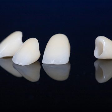 When Do You Need a Dental Crown? Key Signs to Watch